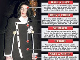 Вскрытие показало: Майкл Джексон перенес 13 пластических операций 
