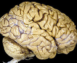Ученые разработали гель, восстанавливающий мозг 