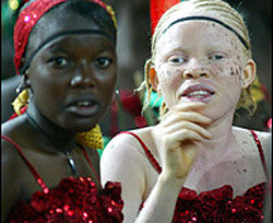 Альбиносы вынуждены скрываться от убивающих их суеверных сограждан  