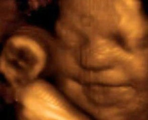 Ученые сфотографировали улыбку еще не рожденного ребенка  