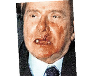 Берлускони отчитается за выбитые зубы 
