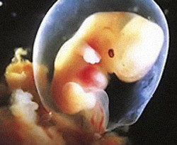 Женщина смогла родить после пересадки яичников 