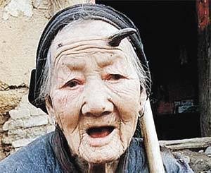 У столетней китайской бабушки растут козлиные рога 