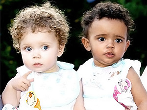 В Англии родились девочки-близнецы: одна темнокожая, вторая - блондинка
