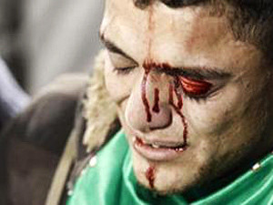 Более 250 человек пострадали в драке после футбольного матча в Иордании