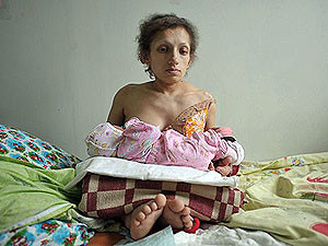 Жительница Львовщины Мария Украинец стала самой маленькой мамой в мире