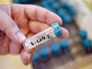Власти Германии объявили о завершении эпидемии E.coli