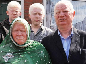 Семью альбиносов-мусульман затравили за брак их дочери с христианином
