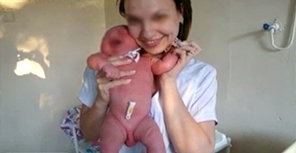 Скандал в Днепропетровске: врачи устроили фотосессию с недоношенными детьми