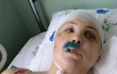 Врадиевское изнасилование: жертва Ирина Крашкова указала на милиционеров 