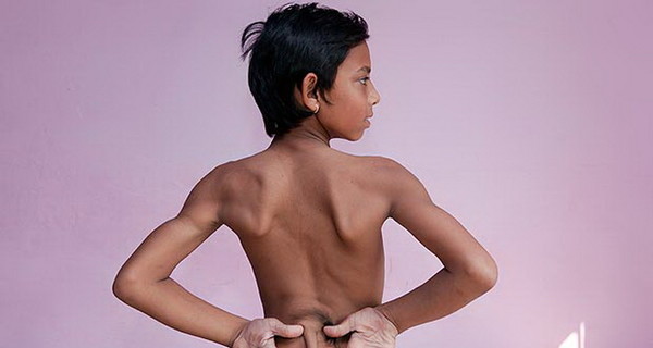 Все больше людей в Индии поклоняются мальчику с хвостом