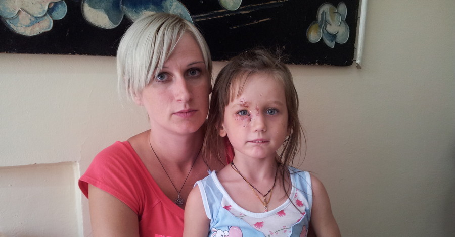 Питбуль вцепился в лицо 5-летней девочки и терзал ее на глазах родителей