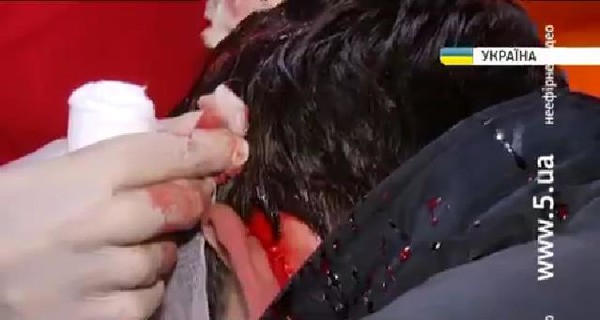 Официально: к врачам обратились 18 пострадавших на Евромайдане
