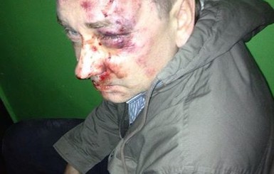 В Сумах избили журналиста