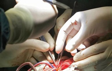 В Киргизии сложнейшую операцию на сердце провели при свете мобильников