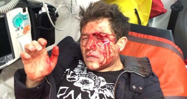В Киеве трое с ножом напали на Андрея Джеджулу