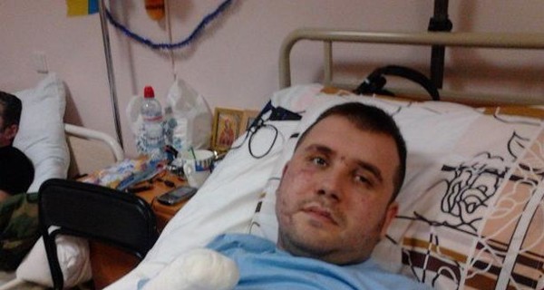 Запорожский боец, спасая солдат, потерял руки и глаз