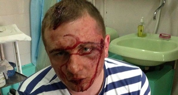 На Киевщине депутату дважды выстрелили в голову в упор