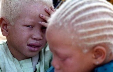 Знахари из Танзании начали охоту за головами кенийских людей-альбиносов