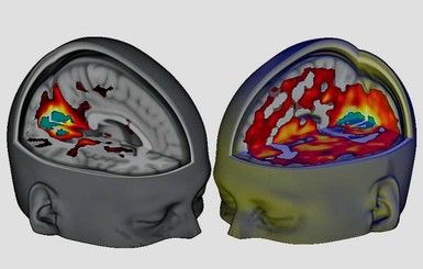 Ученые показали, как выглядит мозг под ЛСД