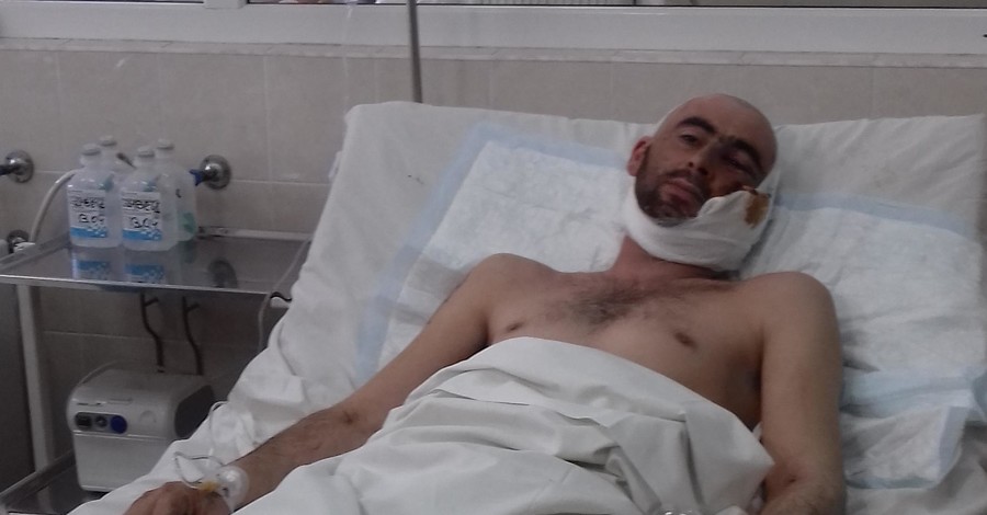 Днепропетровские врачи достали из головы раненого 