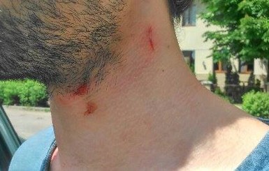 В Харькове пытались задушить журналиста