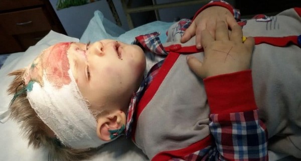 В Одессе собирают помощь для избитого потерявшегося малыша