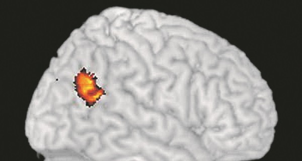 В мозге обнаружен участок, отвечающий за связь с потусторонним миром