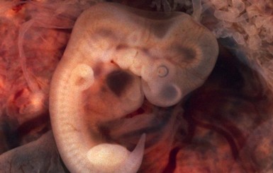 Ученые создали эмбриона-химеру соединив клетки человека и свиньи