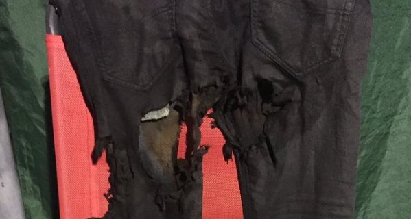 У Вакарчука сгорели джинсы во время 