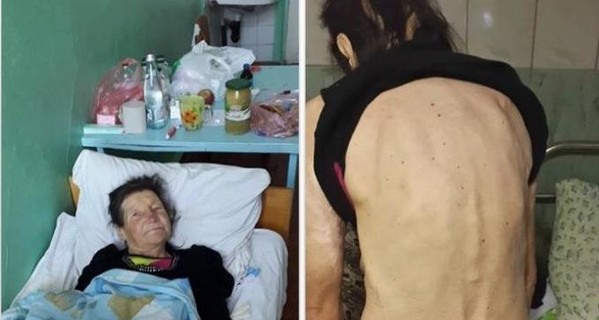 В Одесской области умерла замученная цыганами женщина