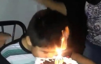 В Чили мальчик загорелся, задувая свечи на торте