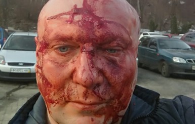 Догхантер Алексей Святогор заявил об избиении после суда