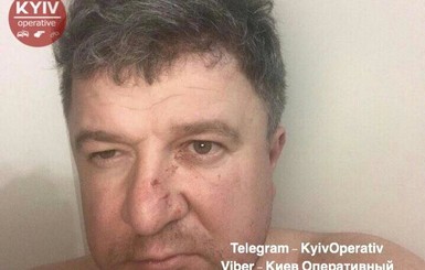 Киевский бизнесмен избил жену и выбросил собаку с 12 этажа