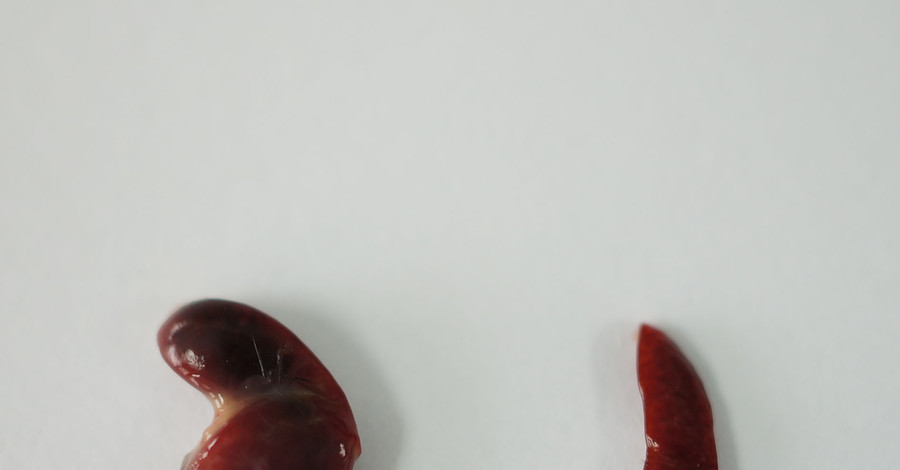 В Китае селезенку превратили в печень внутри живой мыши