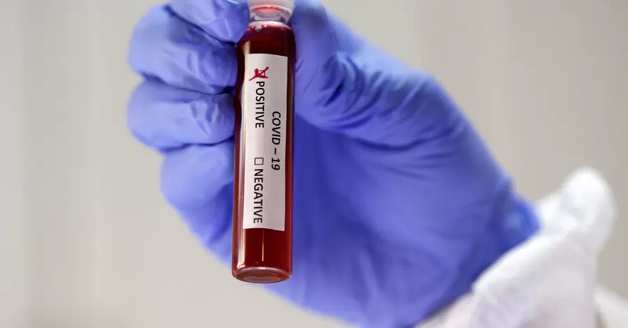 В Чехии обнаружили новый вариант Дельта-штамма коронавируса