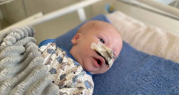 Львовские медики успешно прооперировали младенца с редкой патологией