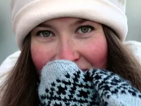 Алергія на холод: що це таке і як із нею боротися