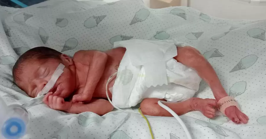 У Львові виходили немовля, яке народилося вагою 600 грамів