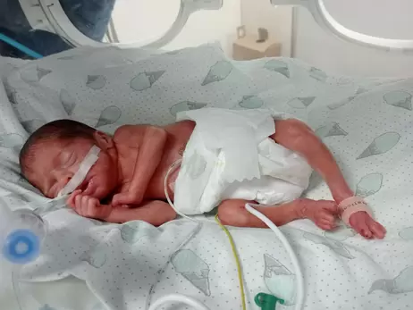 У Львові виходили немовля, яке народилося вагою 600 грамів
