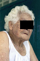 Изнасилована 99-летняя старушка 