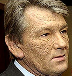 У Виктора Ющенко в крови по-прежнему есть диоксин 