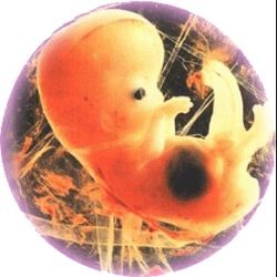Женщине внедрили не тот эмбрион 