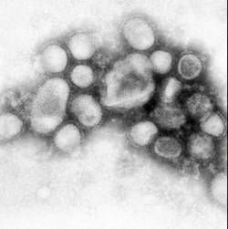 Свиной грипп пробрался в 36 стран 