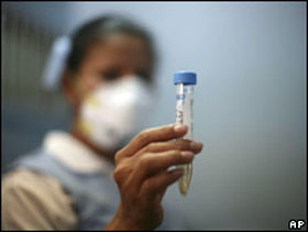 Министр хочет вакцинировать украинцев от свиного гриппа 