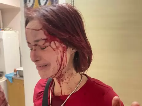 Избиение девушки военным ТЦК в Одессе - таксист и полиция рассказали свою версию
