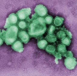 За последние сутки свиной грипп подхватили 70 европейцев 