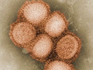 Полторы тысячи человек умерли от свиного гриппа 