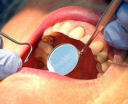 Рассеянный дантист по ошибке выдрал женщине 13 зубов 