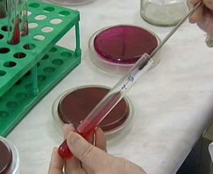 В Украине подтвердились 17 случаев гриппа А/H1N1 